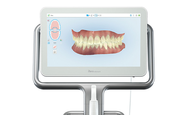 iTero Element(アイテロ エレメント）