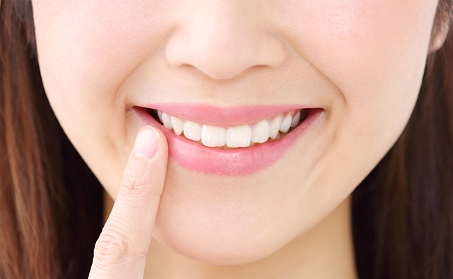 Q：歯の白さはどのくらい維持できるでしょうか？