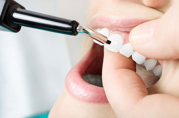 歯の神経が健康かどうかはどうしたらわかるの？