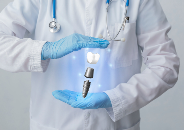 インプラントは人工素材のため虫歯の原因となる酸に影響をうけないことを説明する歯科医師