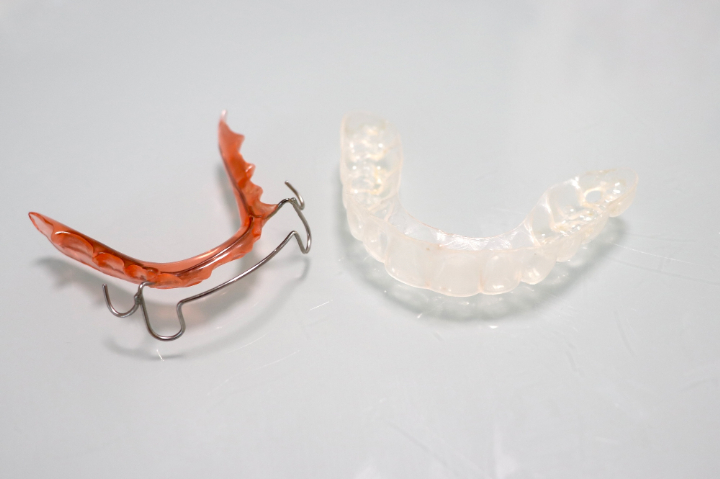 プレートタイプとマウスピースタイプのリテーナー
