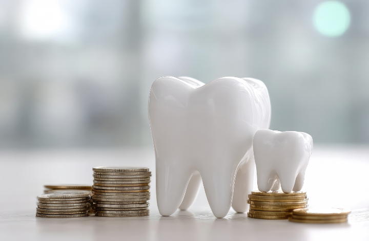 銀歯をセラミックに交換する場合の費用のイメージ