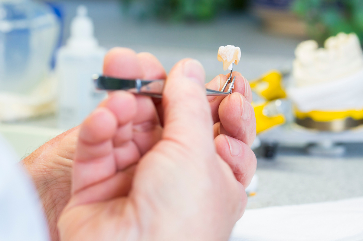 歯科技師が詰め物を作製する様子